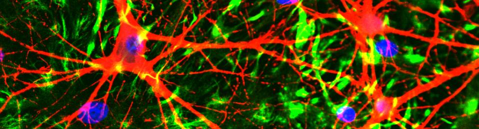 Neurons Glia
