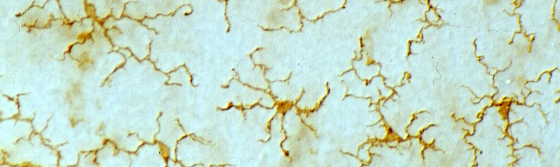 Imagen microglia